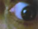 The Eye